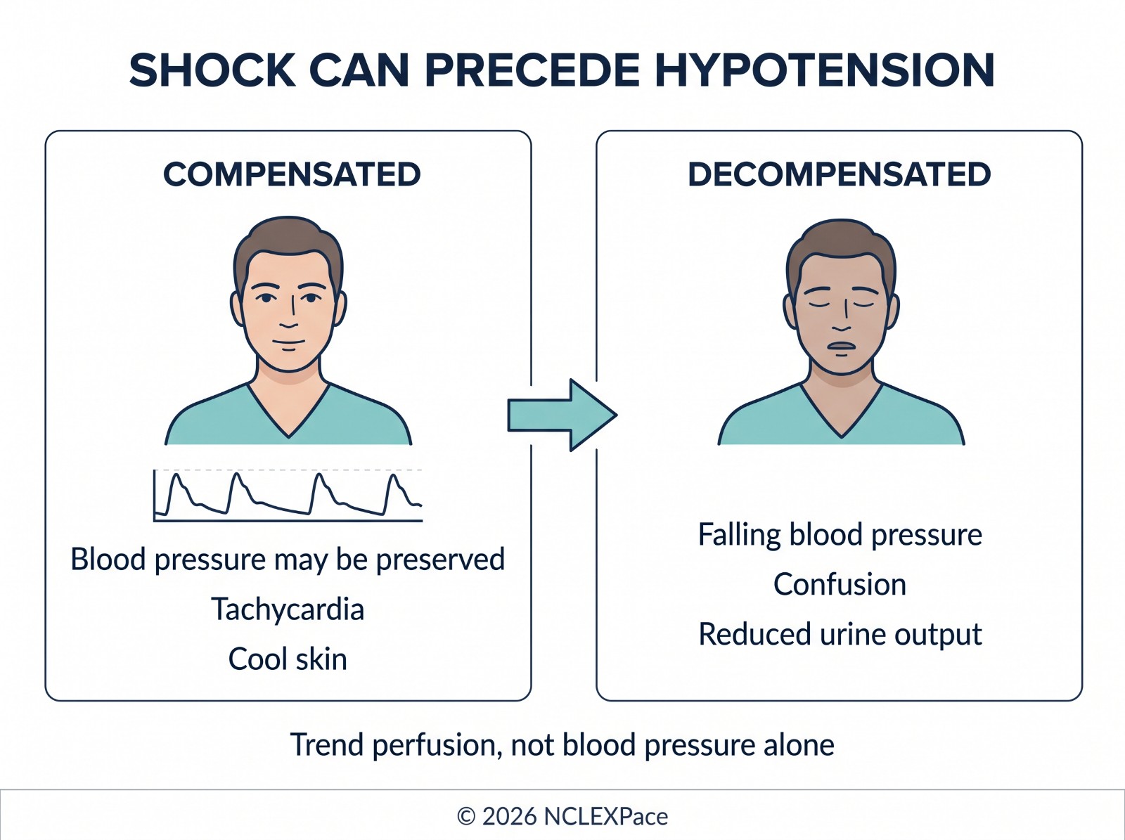 Progression of shock from the compensatory stage through the progressive stage to the refractory stage, with the changes in blood pressure, heart rate, urine output and mental status