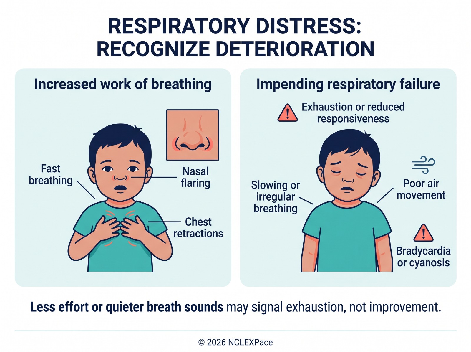 Signs of pediatric respiratory distress: fast breathing, nasal flaring and chest retractions, progressing to exhaustion, slowing or irregular breathing, poor air movement and bradycardia or cyanosis