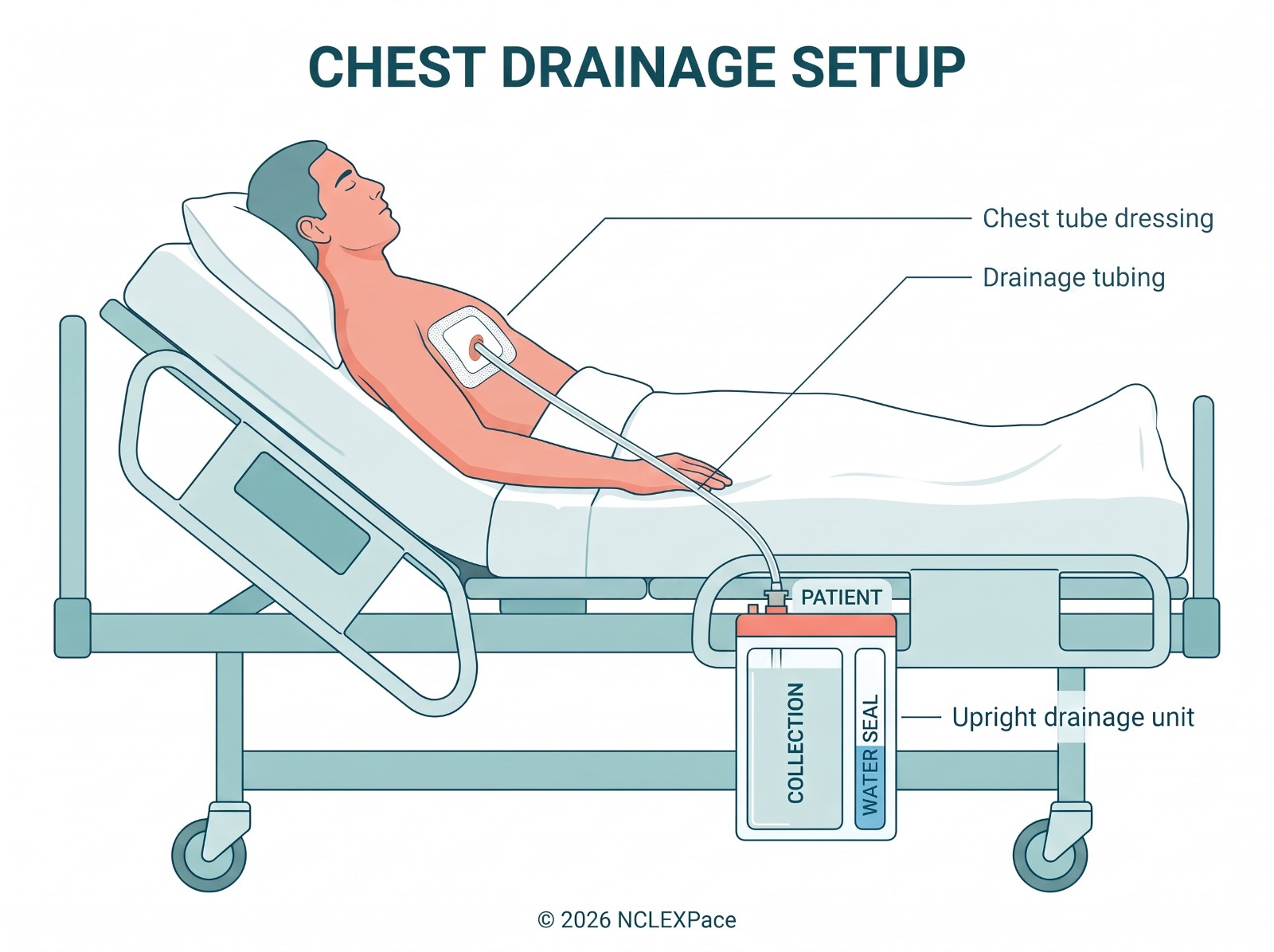 Chest drainage setup: client in bed with the chest tube dressing, drainage tubing and the upright drainage unit with collection and water-seal chambers below chest level