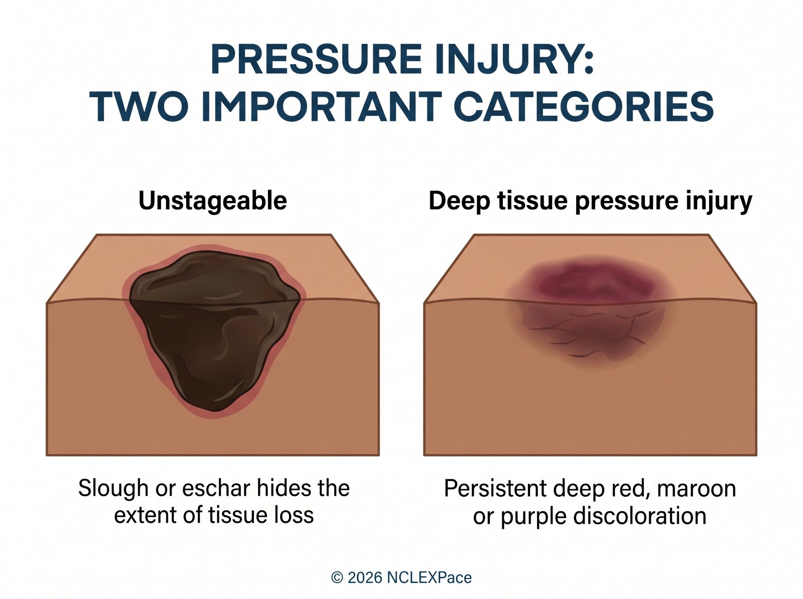 Two pressure injury categories: unstageable, where slough or eschar hides the extent of tissue loss, and deep tissue pressure injury with persistent deep red, maroon or purple discoloration