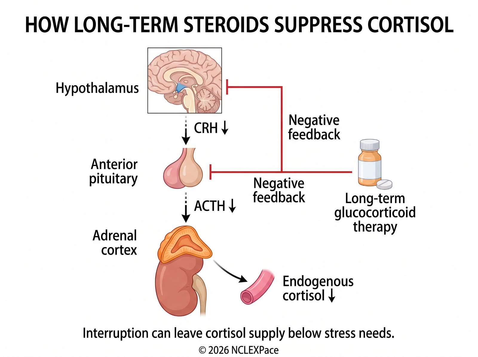 Long-term glucocorticoid therapy suppresses CRH and ACTH through negative feedback, so the adrenal cortex makes less of its own cortisol