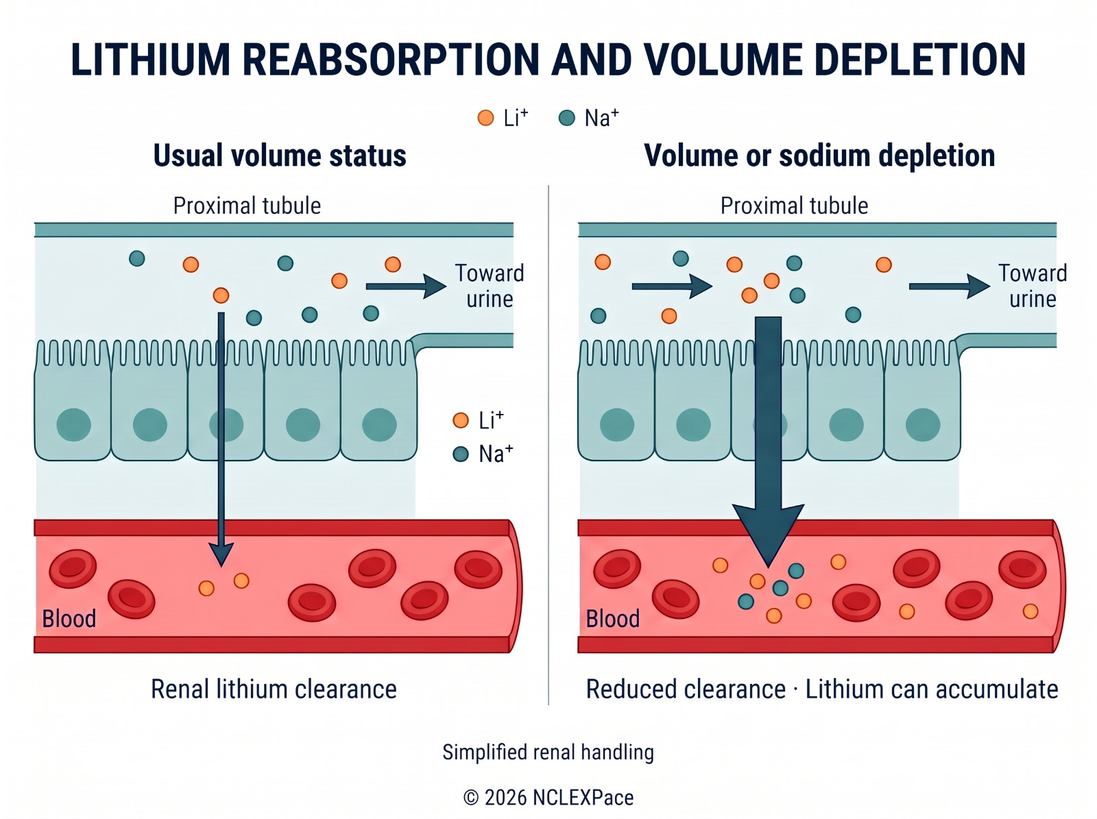 Lithium handling in the proximal tubule: with volume or sodium depletion the kidney reabsorbs more lithium, so the blood level rises